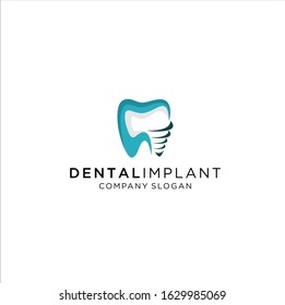 Dental implants symbol. Clean and bright designs.  Idea logo design inspiration