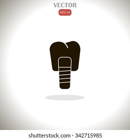 Dental implants vector illustration