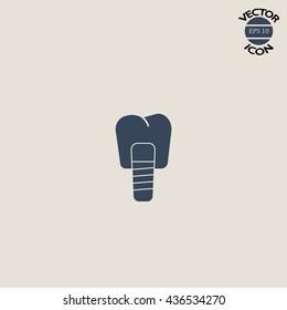Dental implants vector illustration