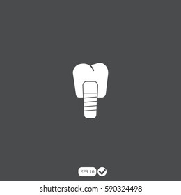 Dental implants vector illustration