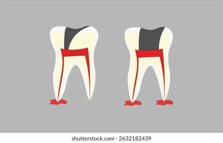 Dental infected teeth vector illustration for use.