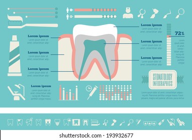 Dental infographic. Flat design dental infographic template includes vector elements: diagrams, charts, dental icon set, tooth illustration, dentist, dental x-ray, dental implant, dental instruments.