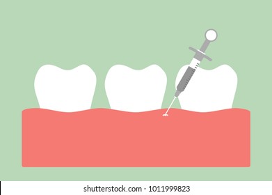 dental injection for tooth extraction, syringe and anesthetizing - teeth cartoon vector flat style cute character for design