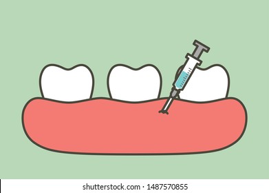 dental injection for tooth extraction, syringe and anesthetizing - teeth cartoon vector flat style cute character for design