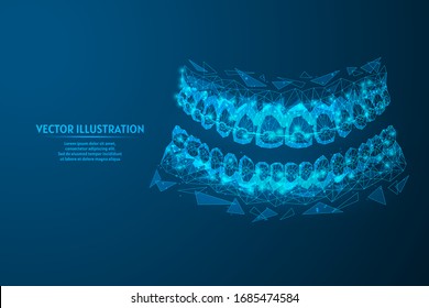 Dental jaw with braces on teeth close-up. Correct bite correction of teeth. Orthodontics, stomotology, innovative medical technology. 3d low poly wireframe isolated vector illustration.