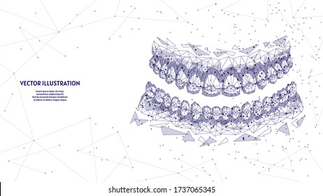 Dental jaw with braces on teeth close-up. Correct bite correction of teeth. Orthodontics, stomotology, innovative medical technology. 3d low poly wireframe vector illustration.