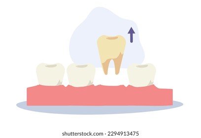 Dental medical concept. tooth extraction . Flat cartoon Vector illustration