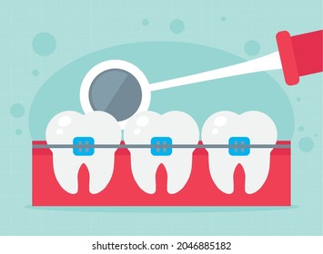 dental mirror showing teeth with brackets