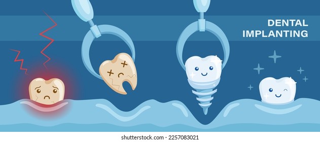 Dental operation poster with showing of removing the ill tooth and replacing it with dental titanium implant. Healthcare poster, banner for dental clinics and surgeries.