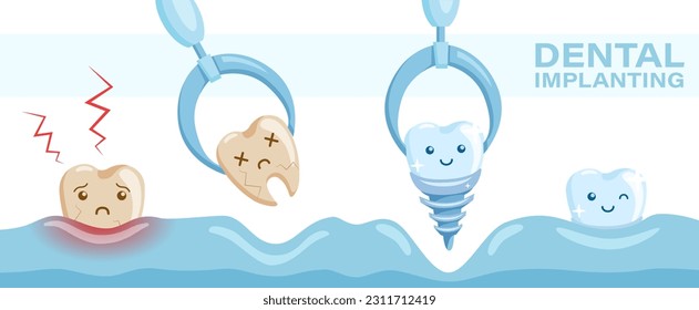 Dental operation white banner with showing of removing the ill tooth and replacing it with dental titanium implant. Healthcare poster, banner for dental clinics and surgeries.