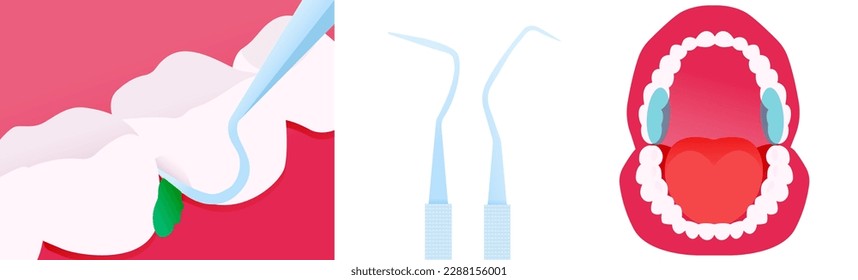 Dental Pick Oral Tool Close Up with Highlighted Upper Back Teeth. Cropped White Teeth with Green Leaf. Healthy Mouth Wide Open Dental Model with Tongue. Modern Flat Vector Illustration.