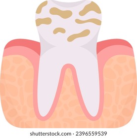 Dental Plaque Tooth Problem Vector Illustration