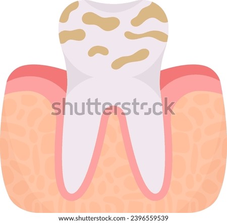 Dental Plaque Tooth Problem Vector Illustration