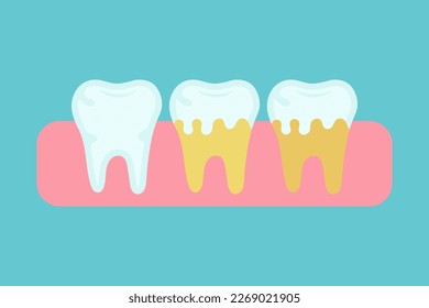 Dental plaque. Yellow teeth. Damaged enamel. Neglected teeth. Dirty teeth. Vector