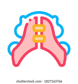 Dental Plate Stomatology Vector Thin Line Icon. Dental Lamina, Dentist Instrument Equipment And Device Linear Pictogram. Medical Treatment Therapy Dentistry Contour Illustration