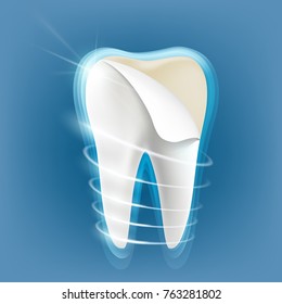 Dental porcelain veneers on a human tooth. Stock vector illustration.