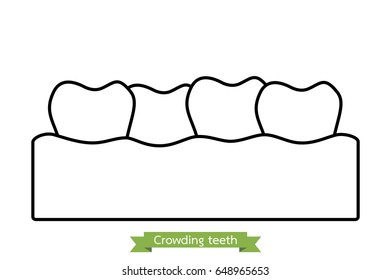 dental problem - crowding teeth ( malocclusion ) - tooth cartoon vector outline style, cute character for design