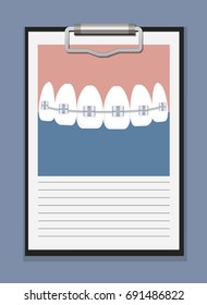 Dental problem health care, health elements infographic, dental concept, showing blank clipboard sign for presentation - vector illustration