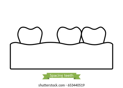 dental problem - spacing teeth ( diastema ) - tooth cartoon vector outline style, cute character for design