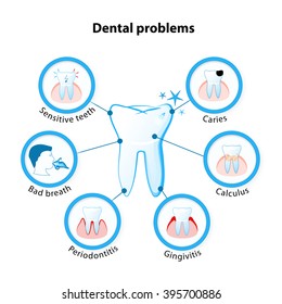 dental problem. Tooth disease: sensitive teeth, caries, calculus, gingivitis, periodontitis and bad breath