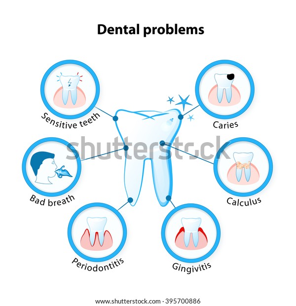 Dental Problem Tooth Disease Sensitive Teeth Stock Vector (Royalty Free