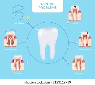 Dental problems circled scheme medical educational poster with diagnosis names vector flat illustration. Tooth disease bad breath, caries, periodontitis, calculus, gingivitis, sensitive teeth