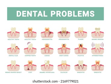 dental problems. infografic template with damaged teeth and bad oral breath. Vector flat pictures set