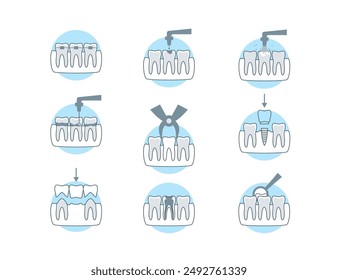 Klinik für Zahnbehandlung Zeichen Farbe Dünne Linie Icon Set Einschließlich Implantat und Kieferorthopädie . Vektorillustration von Zahnheilkunde-Icons