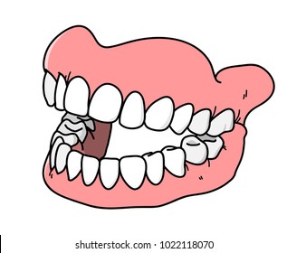 Dental Prosthesis, a hand drawn vector cartoon illustration of a prosthetic teeth.