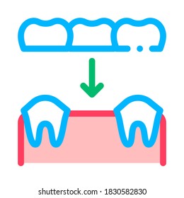 Dental Prosthesis Stomatology Vector Sign Icon Thin Line. Stomatology Dentist Instrument Equipment And Device Linear Pictogram. Medical Treatment Therapy Dentistry Contour Illustration