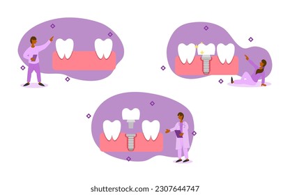 dental prosthetics illustration set. dentist inserts implant body into gum to prepare abutment with crown. dental implant to replace missing tooth. dental implant treatment concept vector.