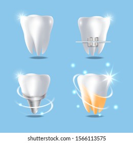 Dental services, vector isolated illustration. White brilliant healthy tooth, dental braces, implant and teeth whitening. Dentistry concept for poster, banner, website page etc.