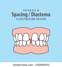 Dental spacing or diastema teeth illustration vector design on blue background. Dental care concept.