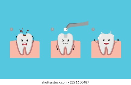 Dental Step of restoring cavity tooth by filling tooth illustration cartoon character vector design on blue background. Dental care concept.