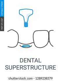 Dental Superstructure Installation