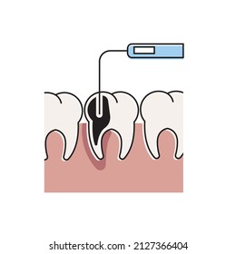 dental surgery. dental treatment and dental care. health concept. Can use for web banner, infographics. Flat vector illustration isolated on white background.