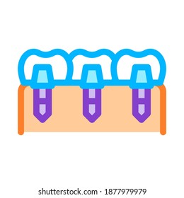 Implante De Dientes Dentales Icono De Vector Biomaterial De Línea Delgada. Máquinas De Biología Y Ciencia, Bioingeniería, Adn Y Medicina Concepto Biomaterial Pictograma Lineal. Ilustración de contorno