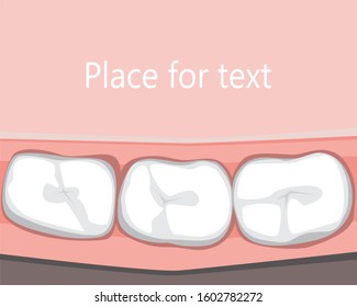 Dental template with teeth. Flat vector stock illustration. Blank template with place for text, copy space. Illustration or template as banner, card with tooth, molar, teeth