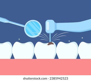 Dental treatment. Drilling a tooth. Dental drill and dental mirror. Treatment of caries. Professional dentist appointment. A tooth with a carious cavity. Oral hygiene. Vector illustration