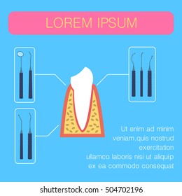 Dental treatment Vector illustration The sick and the healthy teeth, dental care and set of dental instruments Poster Flat design