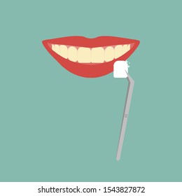 Dental veneers on a human tooth. Vector illustration.