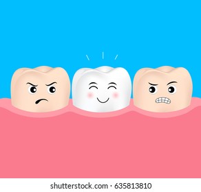 Dental veneers tooth character.  Before and After, whitening oral care concept. Deep cleaning, clearing tooth process.  illustration on blue background.