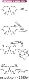 Dental wisdom tooth extraction icon set