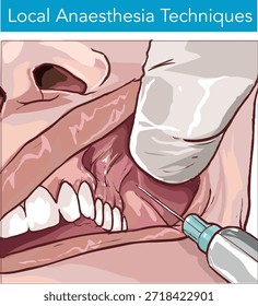 Dentista aplicando anestesia ao paciente