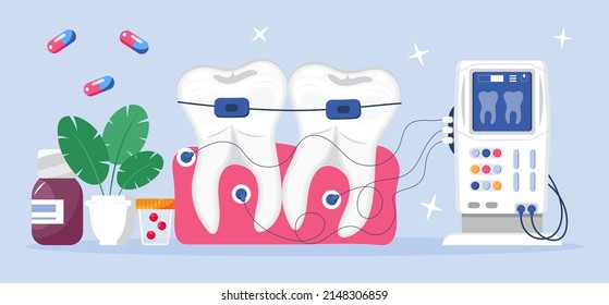 Dentist concept vector. Caries, tartar or tooth cyst treatment. Dental crown and filling, whitening of teeth. Removal tooth and x-ray. Orthodontist treat  pulpitis, periostitis, alveolitis.