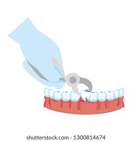 dentist extracting tooth with pliers