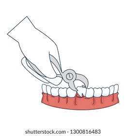 dentist extracting tooth with pliers