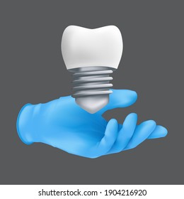 Dentist hand wearing blue protective surgical glove holding a ceramic model of the tooth. 3d realistic vector illustration of dental implants concept isolated on a grey background