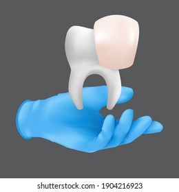 Dentist hand wearing blue protective surgical glove holding a ceramic model of the tooth. 3d realistic vector illustration of porcelain veneers concept isolated on a grey background