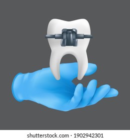 Dentist hand wearing blue surgical glove holding a ceramic model of the tooth with metal brace. 3d realistic vector illustration of an orthodontic treatment concept isolated on a grey background